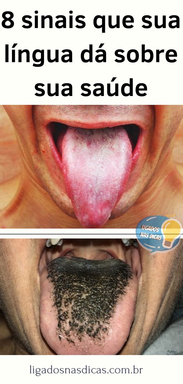 8 sinais que sua língua dá sobre sua saúde 8 sinais que sua língua dá sobre sua saúde