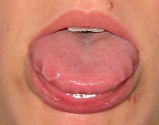 8 sinais que sua língua dá sobre sua saúde
