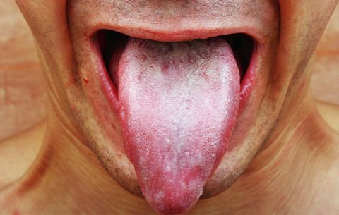 8 sinais que sua língua dá sobre sua saúde