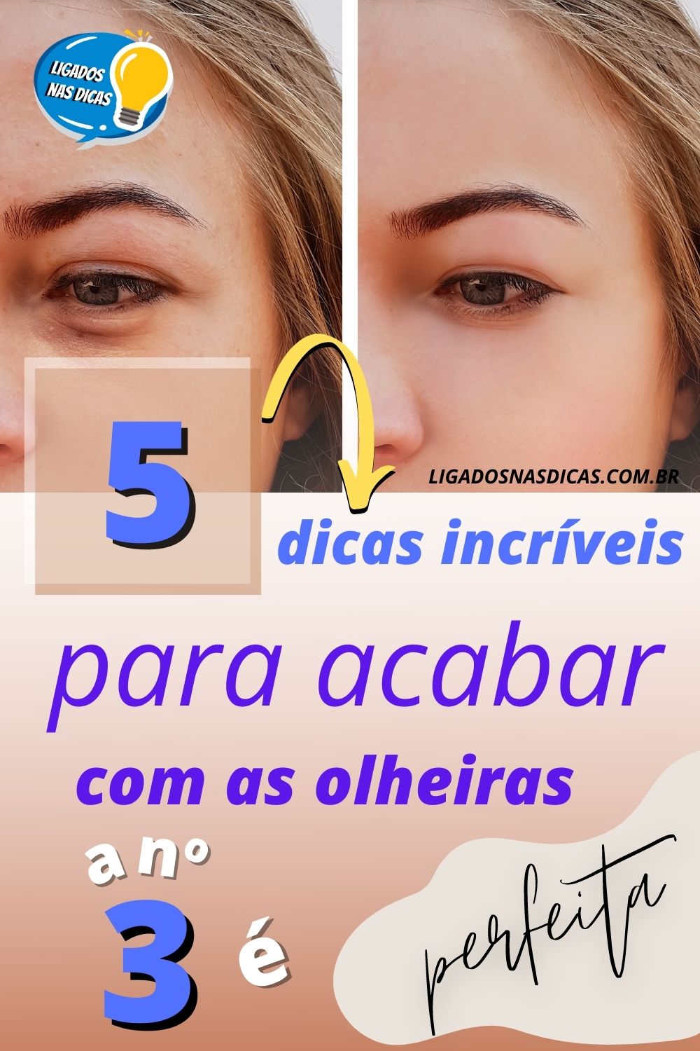 dicas caseiras para acabar com olheiras