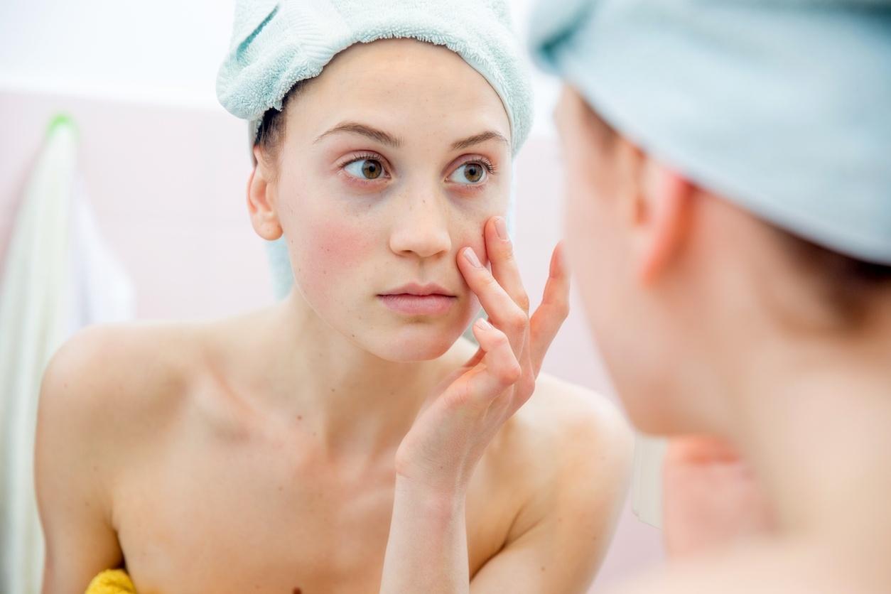 dicas caseiras para acabar com olheiras dicas caseiras para acabar com olheiras